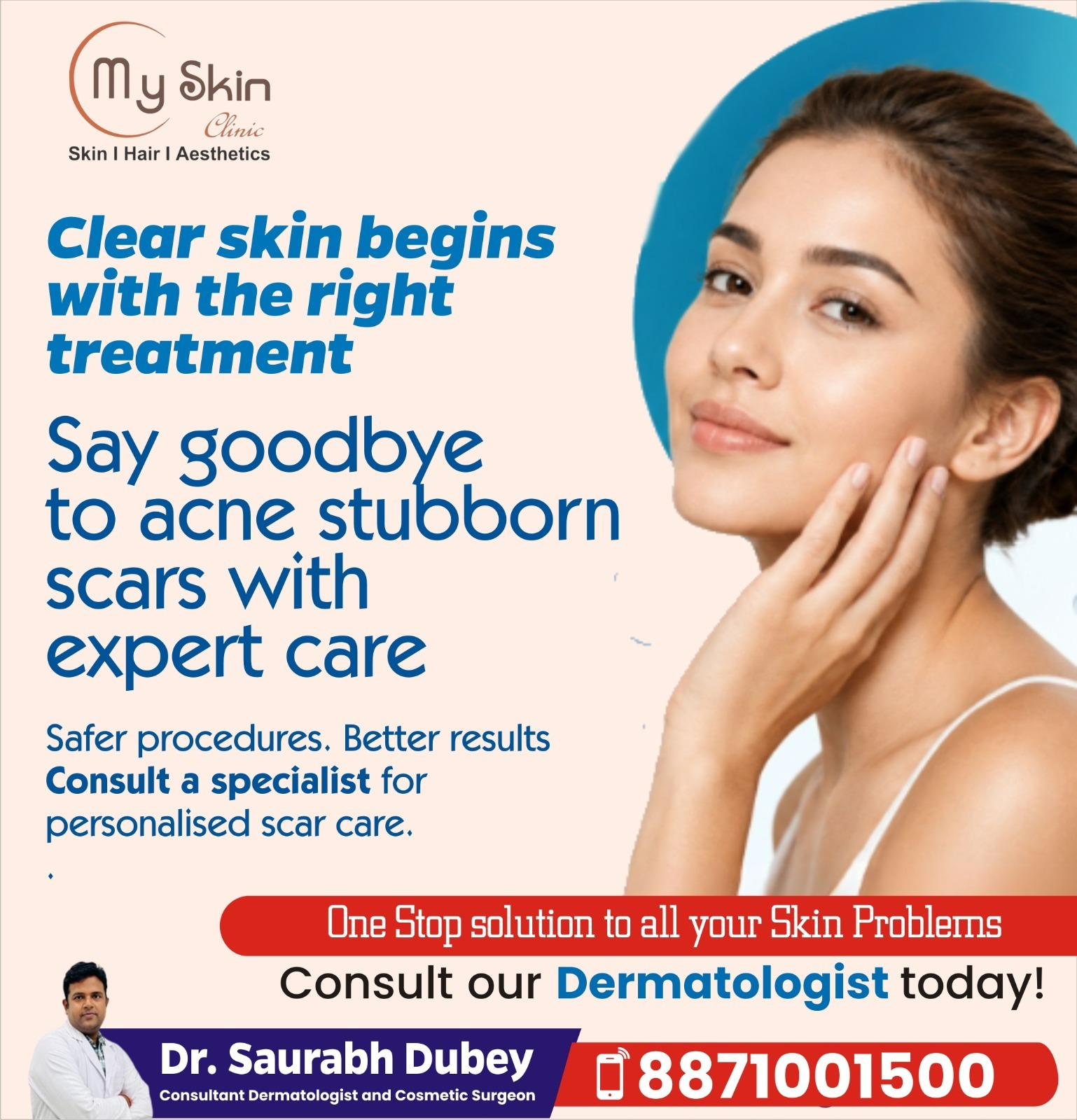 Acne Scar Treatment in Indore